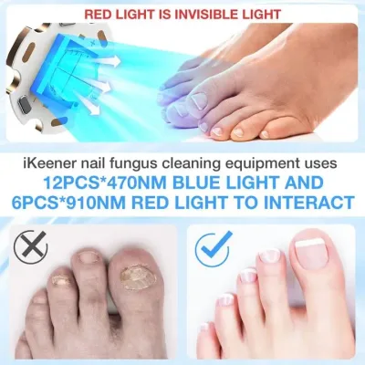 Appareil laser pour ongles des pieds, format voyage – image 2