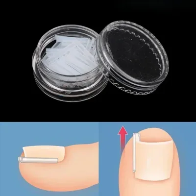 Kit de 50 pièces pour soin des ongles incarnés – image 3