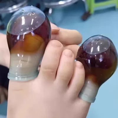 Protège-orteil en silicone souple